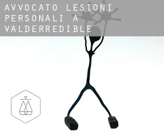 Avvocato lesioni personali a Valderredible