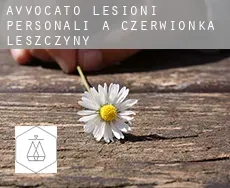 Avvocato lesioni personali a Czerwionka-Leszczyny